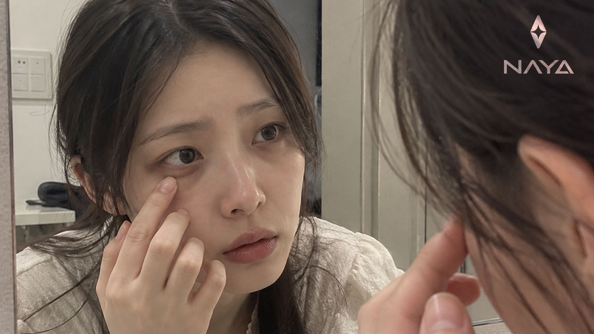 다크써클색소침착형
